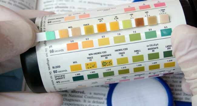 Clinical-Article-Urinalysis-1140x760-2